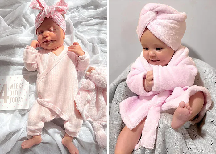 The Rare Condition Behind A Baby's Viral Smile