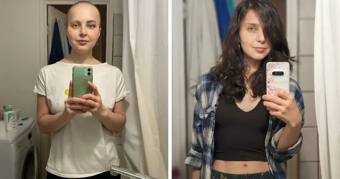 31 People Who Are Completely Unrecognizable From Who They Were 3 Years Ago