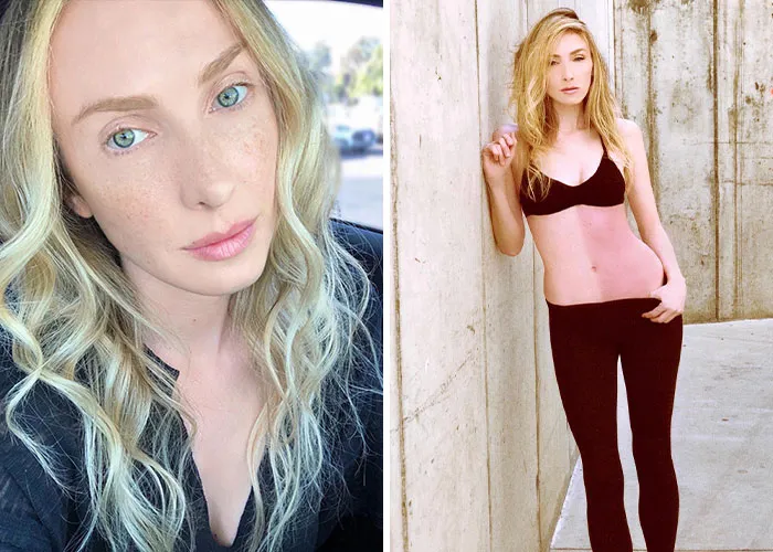 The Woman Whose Body Is Made Of Two Different People
