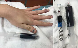 17 Bizarre Medical Problems And Mysteries That Catapulted People Into The News