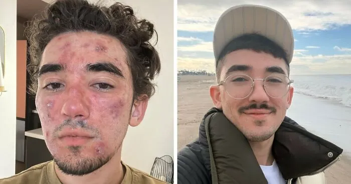 31 People Who Are Completely Unrecognizable From Who They Were 3 Years Ago