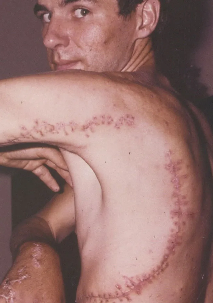 “Should Have Been 100% Fatal”: 49 Times Humans Survived The Most Terrifying Situations