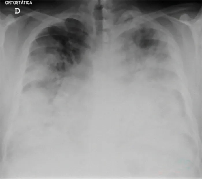 37 Doctors Share Which Diseases Should Scare People More Than They Do