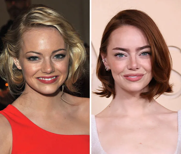 Emma Stone