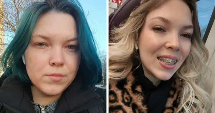 31 People Who Are Completely Unrecognizable From Who They Were 3 Years Ago