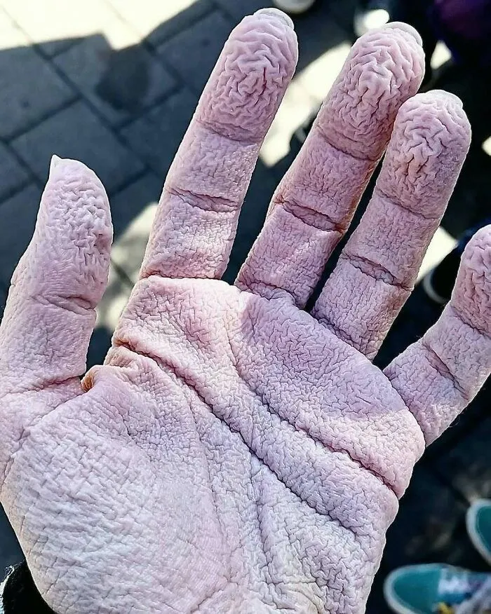 30 Imágenes médicas fascinantes pero ligeramente inquietantes