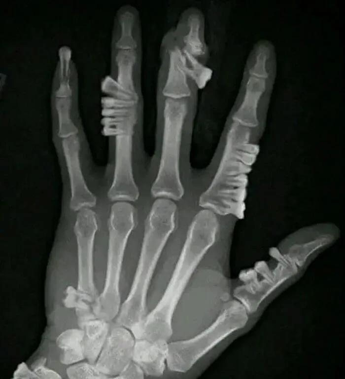 Creepy-Medical-Pics