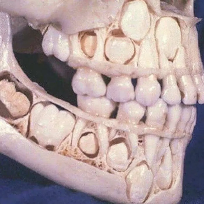 30 Imágenes médicas fascinantes pero ligeramente inquietantes