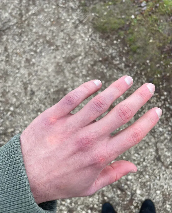 73 People Who Ended Up In The ER For The Stupidest And Most Ridiculous Reasons