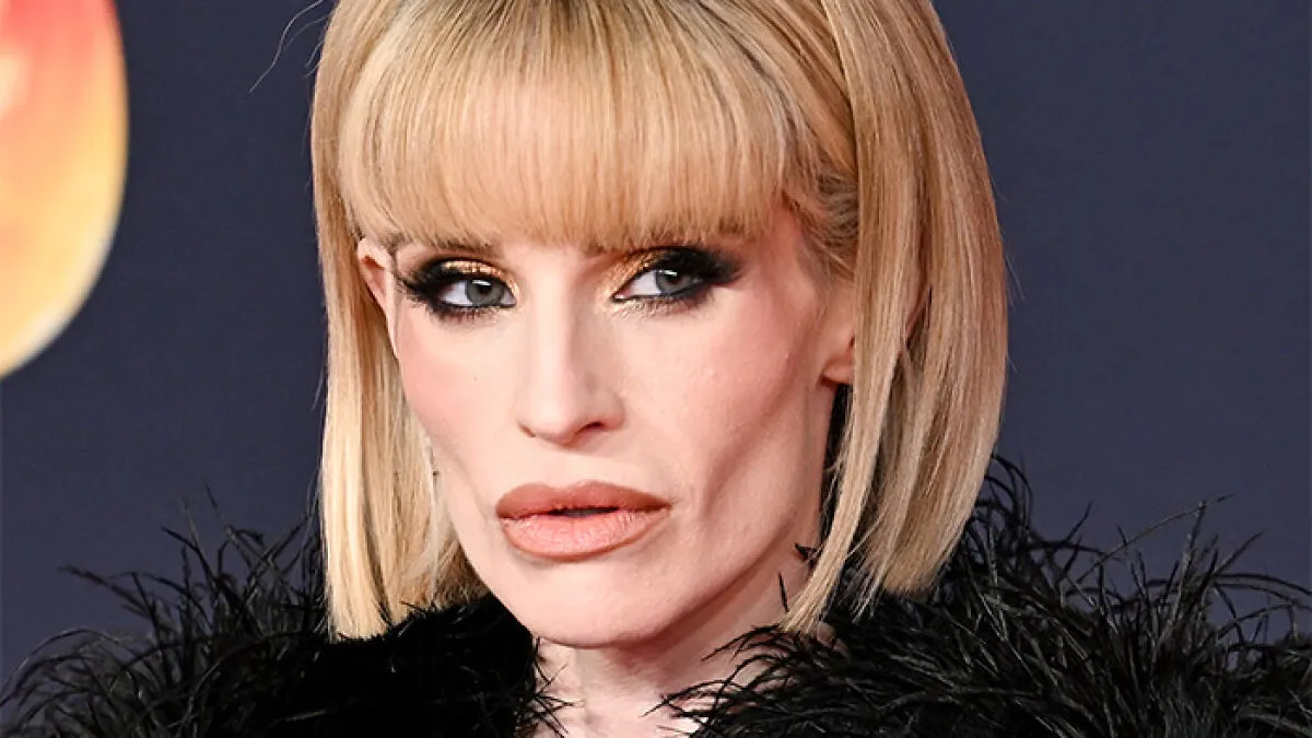 Fans Accuse Kelly Osbourne Of Buccal Fat Removal As Her Brit Awards Look Goes Viral