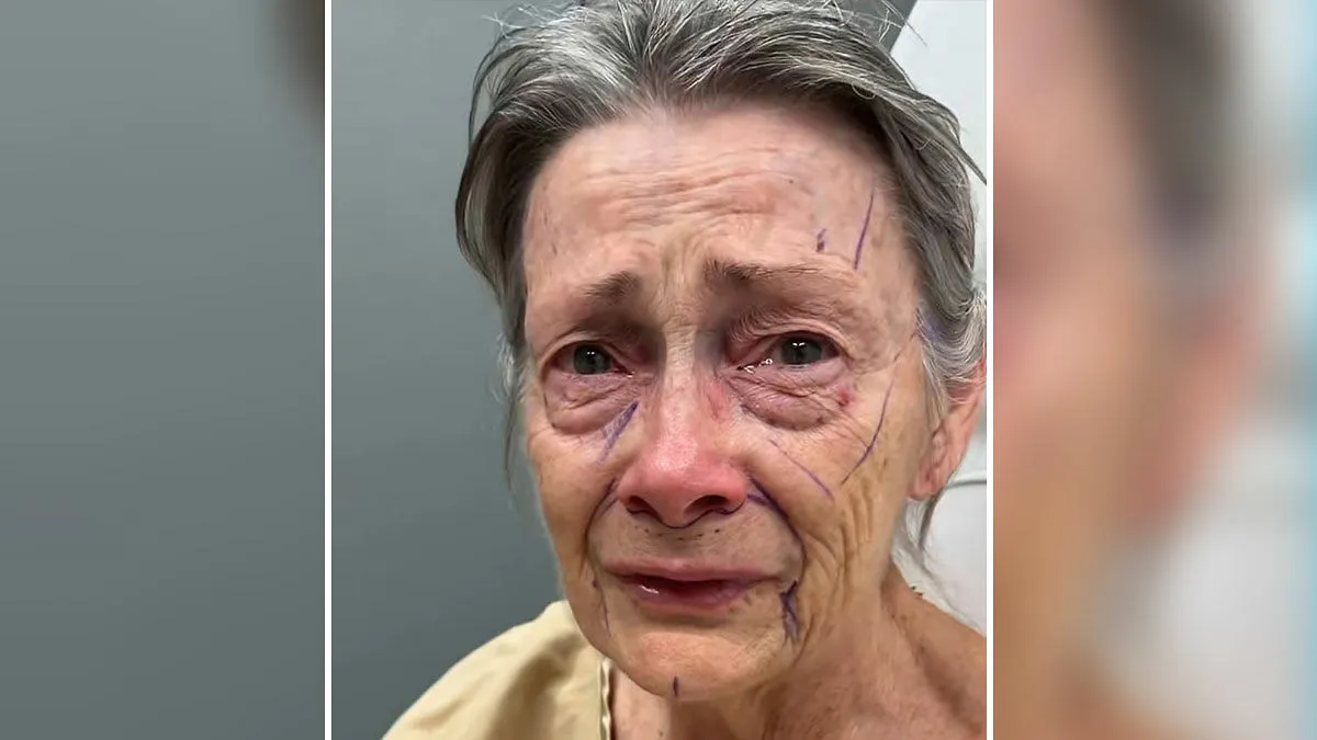 ‘Miracle’ Plastic Surgeon Goes Viral After Transforming Grandma To Look Decades Younger