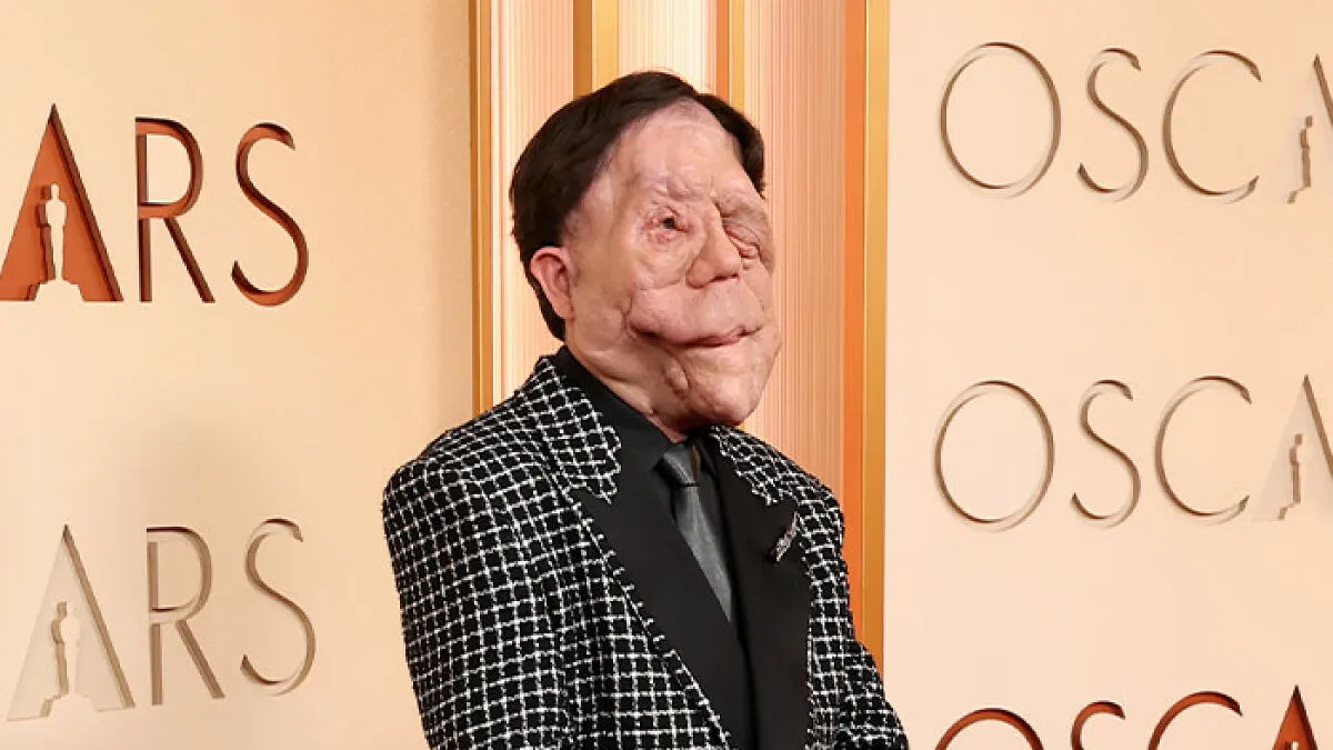Adam Pearson Joins Fans In Calling Out Comedian’s Offensive Tweet About Him