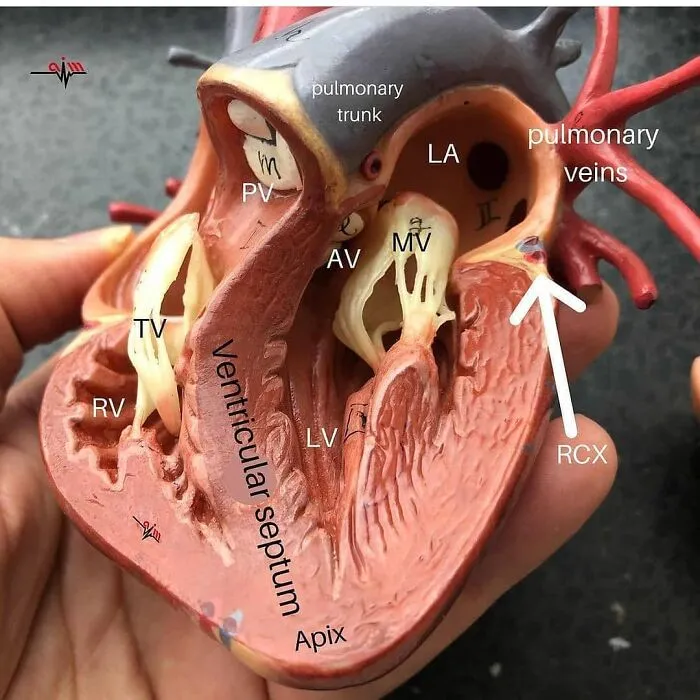Detailed anatomical heart model showing labeled valves and chambers, an unusual medical photo blending science and nightmare elements