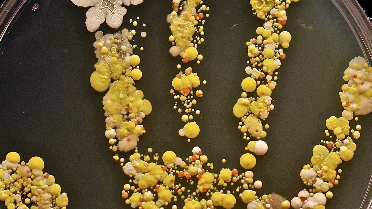 69 Medical Images And Cases That Are Equal Parts Fascinating And Deeply Disturbing