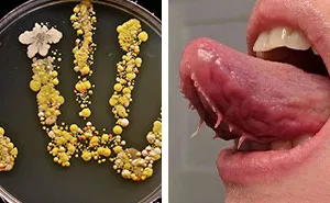 69 Medical Images And Cases That Are Equal Parts Fascinating And Deeply Disturbing