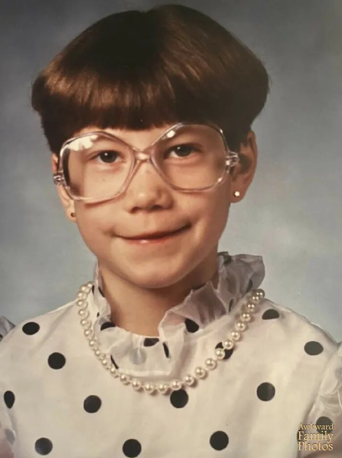 My Grade 1 Photo Taken After My Mother Convinced Me Chicken Pox Can Be Cured With A Bowl Cut