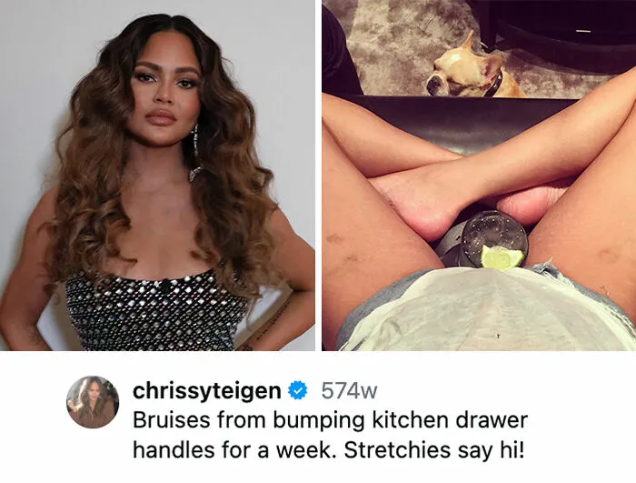 Chrissy Teigen