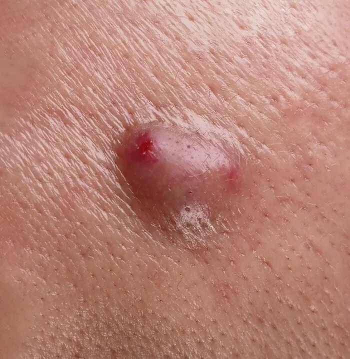 28 Times Doctors And Nurses Encountered Something Truly Revolting
