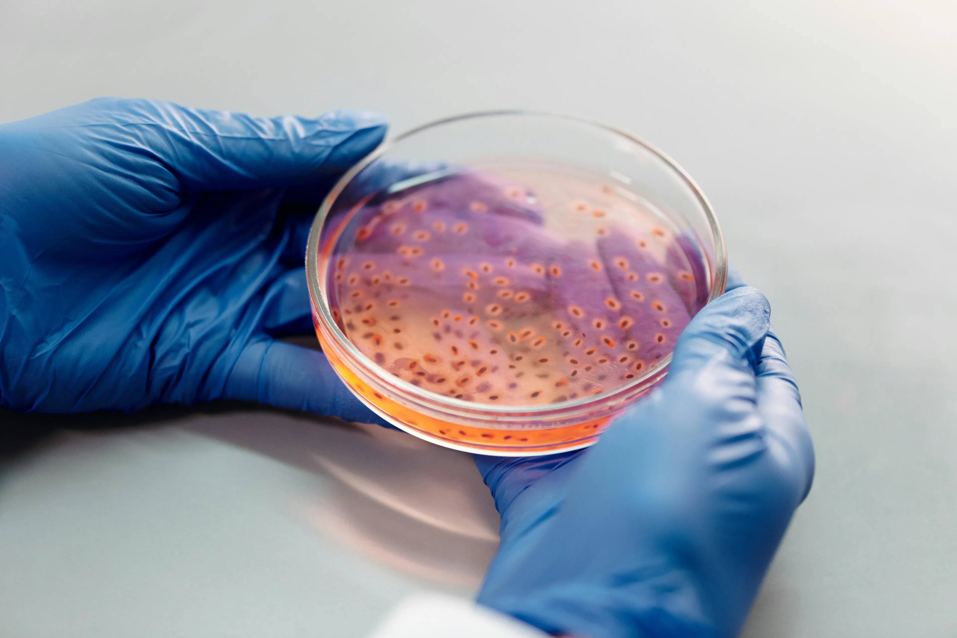 Hands wearing blue gloves holding a petri dish with pink cell cultures showing the process of cell division.
