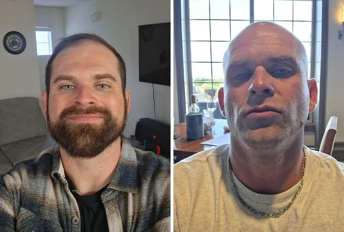 Is It Better This Way? Before vs. After