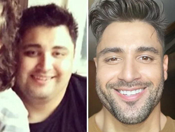 I Lost 120 Lbs. From Fake Smile Because I Was Depressed And Hated Myself To Genuinely Real Smile Because I’m Much Happier With Who I Am