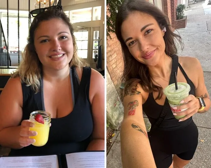 138 Lbs Down. Skin Surgery In Just 2 Weeks