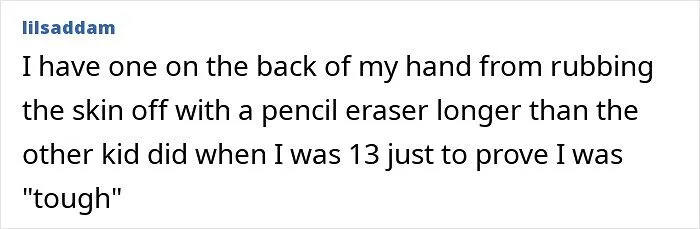 “Pressure Washer”: 47 Dumb Ways People Got Scars, And It’s Painfully Relatable