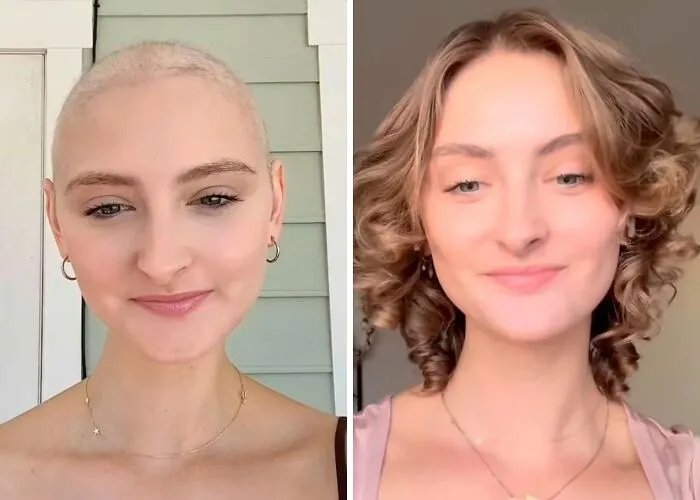 Shoutout To Sis.. The Growth One And A Half Years Post Treatment 🥹