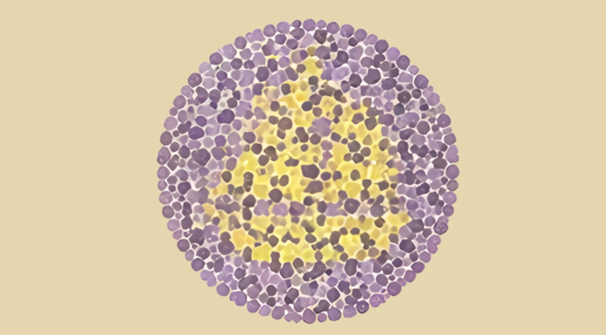 Color blindness test plate showing purple and yellow dots forming a shape for vision challenge evaluation.
