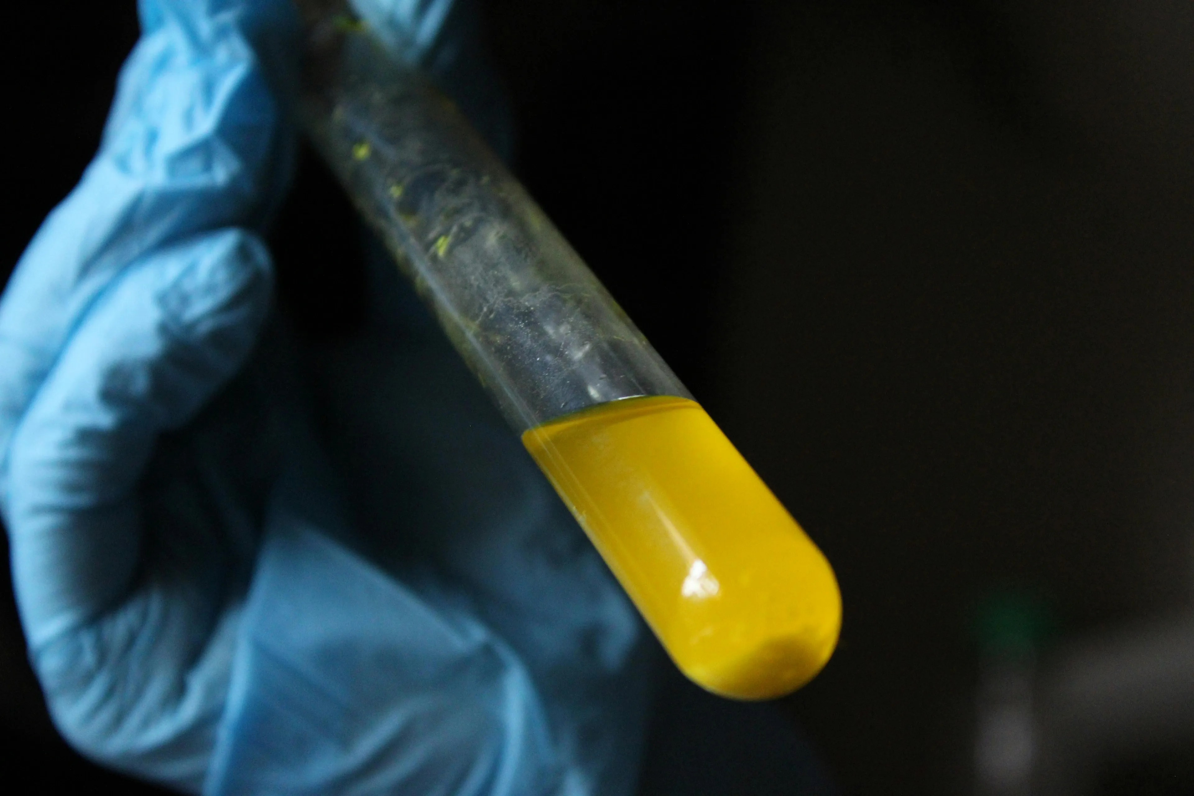 Gloved hand holding a test tube with yellow liquid representing urine in a high school biology human body quiz.