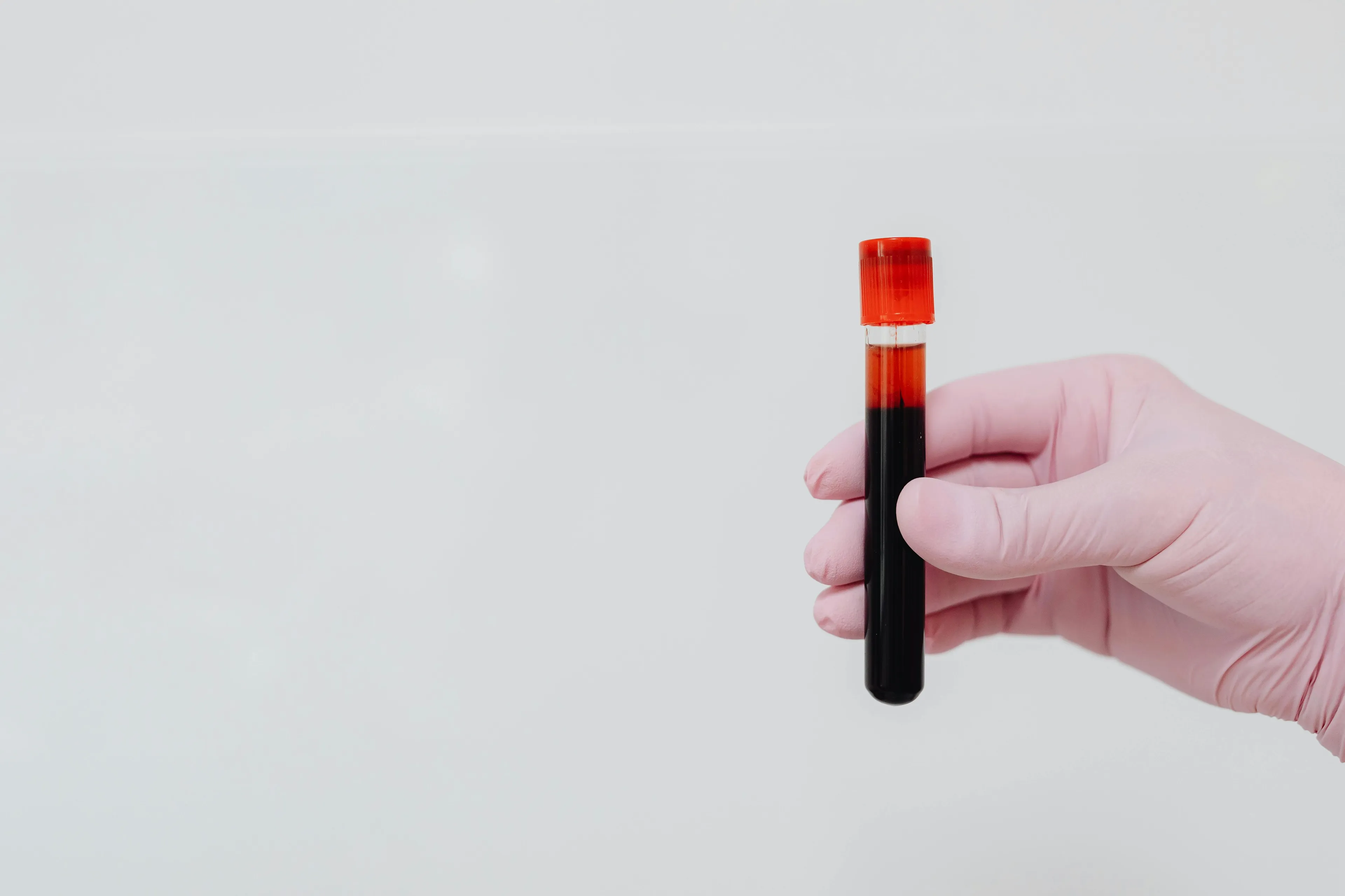 Hand wearing pink glove holding a test tube with blood sample for high school biology blood group universal donor quiz.