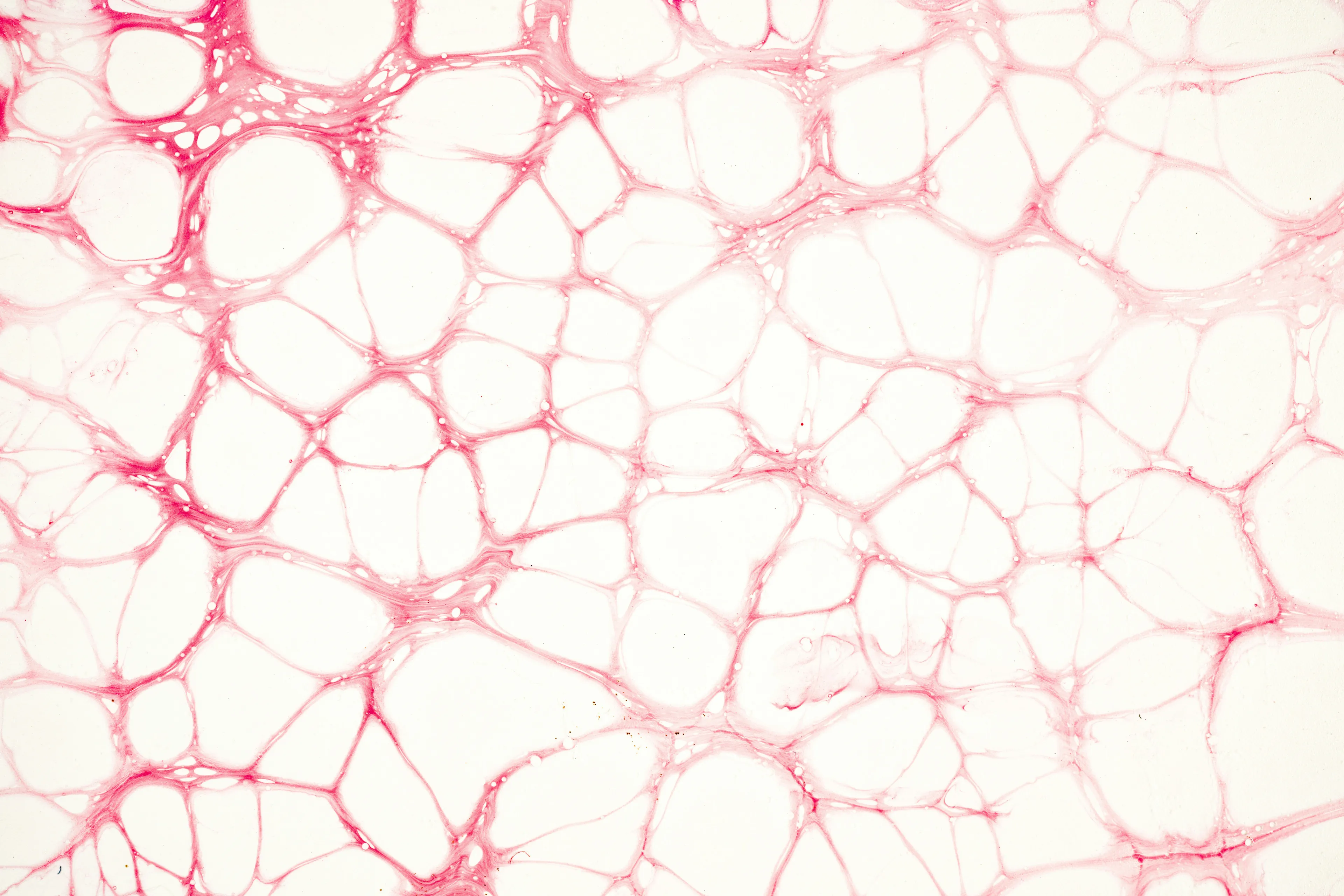 Close-up microscopic view of skin layer showing connective tissue with blood vessels, nerves, and sweat glands structures.