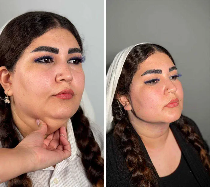 This Plastic Surgery Clinic’s Before-And-After Transformations Have Gone Viral Online (31 Pics)