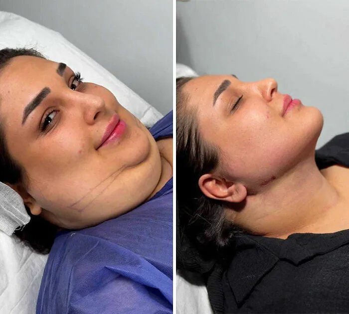 This Plastic Surgery Clinic’s Before-And-After Transformations Have Gone Viral Online (31 Pics)