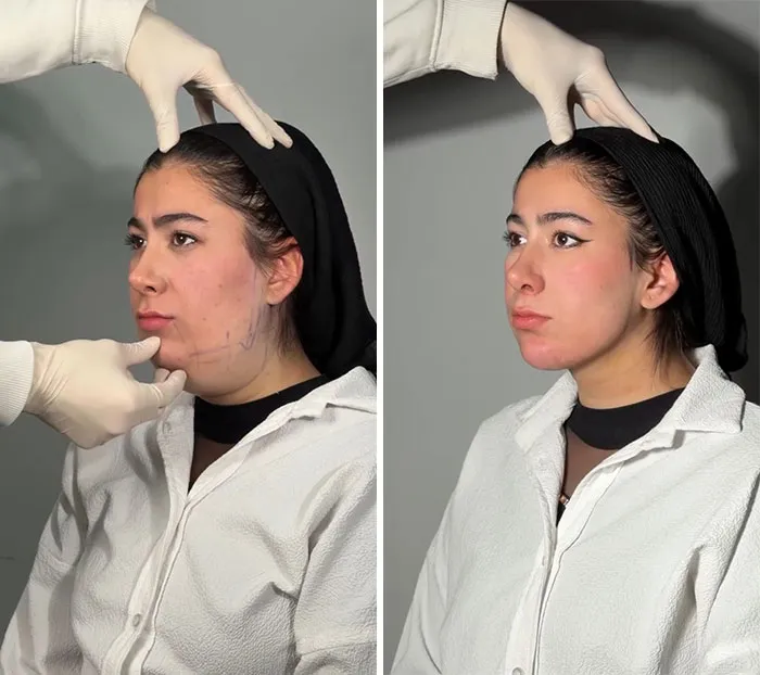 This Plastic Surgery Clinic’s Before-And-After Transformations Have Gone Viral Online (31 Pics)