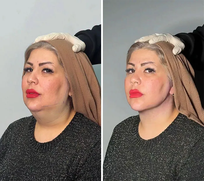 This Plastic Surgery Clinic’s Before-And-After Transformations Have Gone Viral Online (31 Pics)