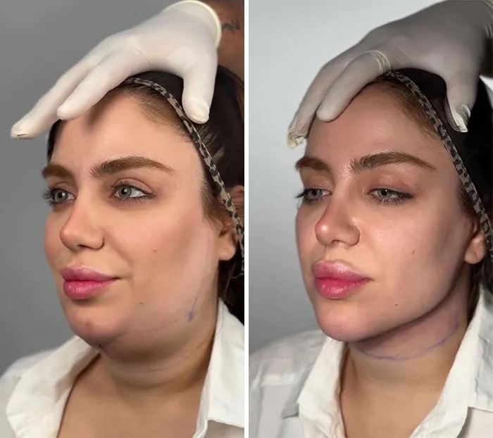 This Plastic Surgery Clinic’s Before-And-After Transformations Have Gone Viral Online (31 Pics)