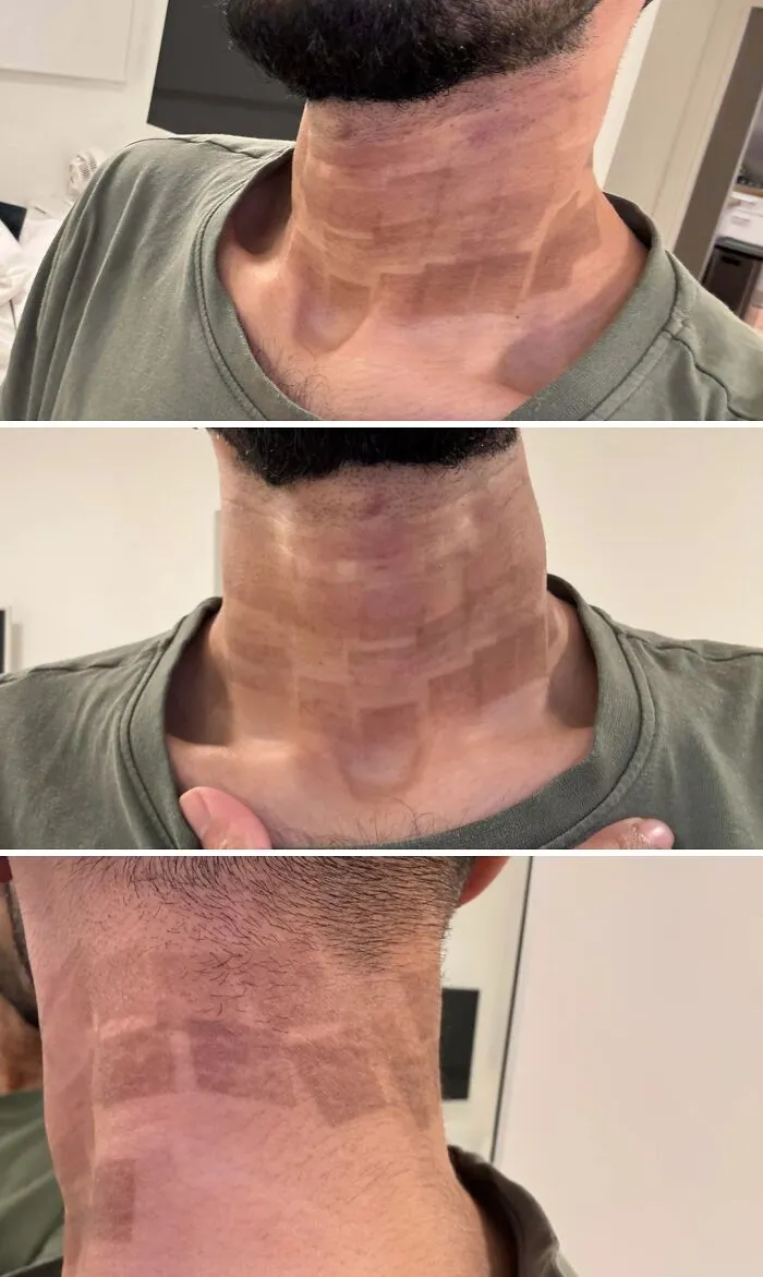 Co2 Laser Gone Wrong / Botched