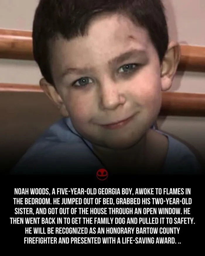“Unknowingly Missing 90% Of His Brain”: 43 Interesting Facts And Photos That Are Also Kind Of Creepy