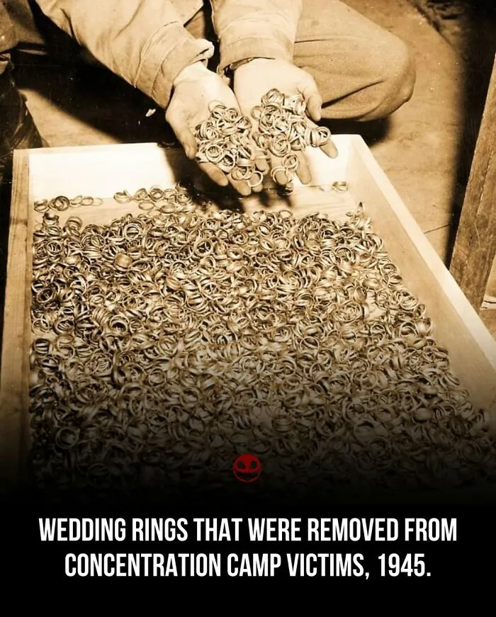 “Unknowingly Missing 90% Of His Brain”: 43 Interesting Facts And Photos That Are Also Kind Of Creepy