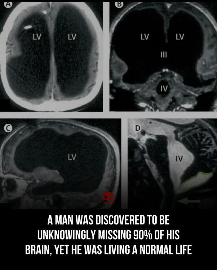 “Unknowingly Missing 90% Of His Brain”: 43 Interesting Facts And Photos That Are Also Kind Of Creepy