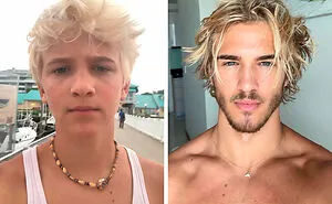 From Bone Smashing To Chin Extensions, These “Looksmaxxing” Changes Are Hard To Ignore