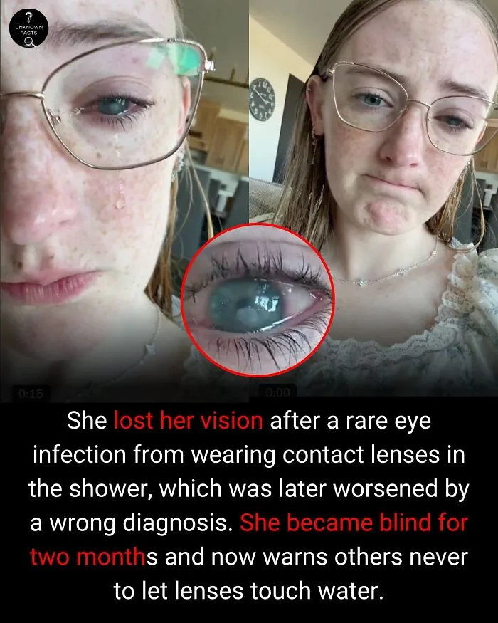 A girl with glasses, crying due to a severe eye infection, offering an interesting fact about contact lenses.