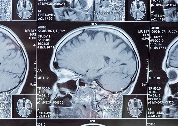 Close-up of brain MRI scans showing detailed cranial structures related to unproven scientific theories by top scientists.