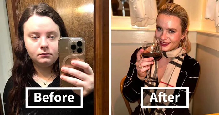 Woman Looks Unrecognizable After 1.5 Years, Gets Honest About How She Achieved It