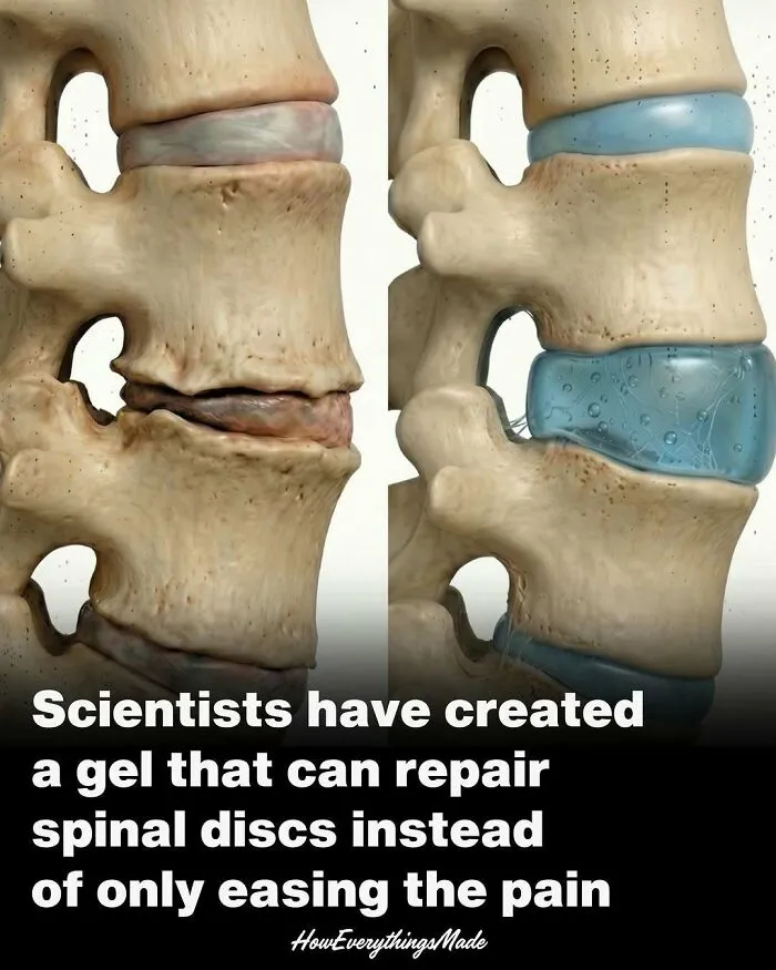 79 Bizarre Facts And Stories About The World That Might Break Your Brain
