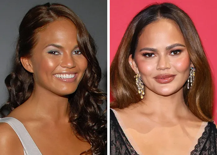 Chrissy Teigen