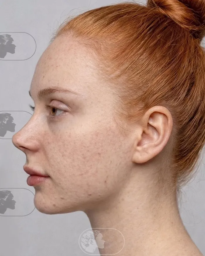 25 Personas que se ven irreconocibles tras su cirugía plástica