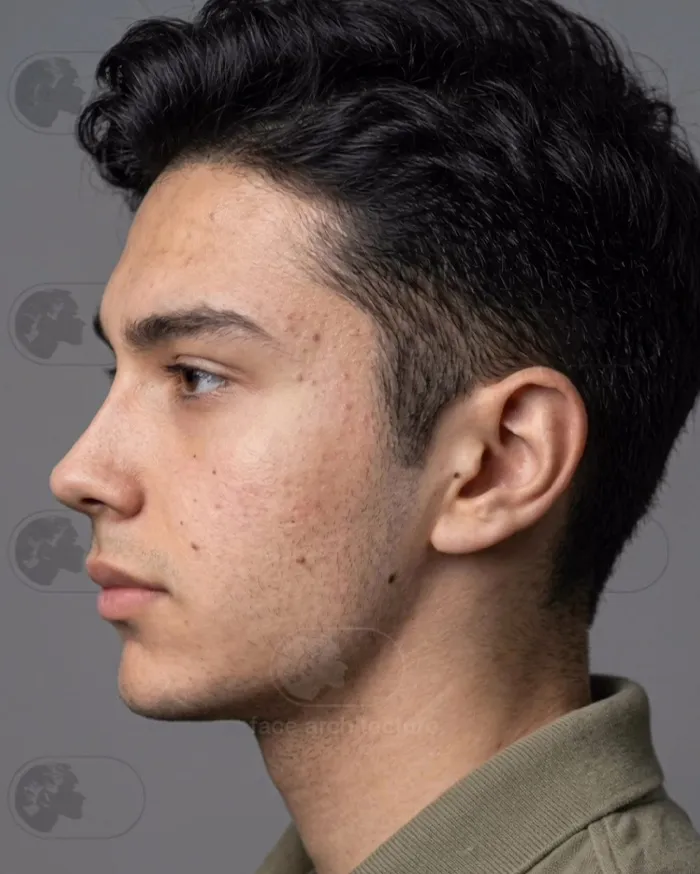 25 Personas que se ven irreconocibles tras su cirugía plástica