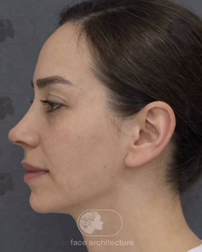 25 Personas que se ven irreconocibles tras su cirugía plástica